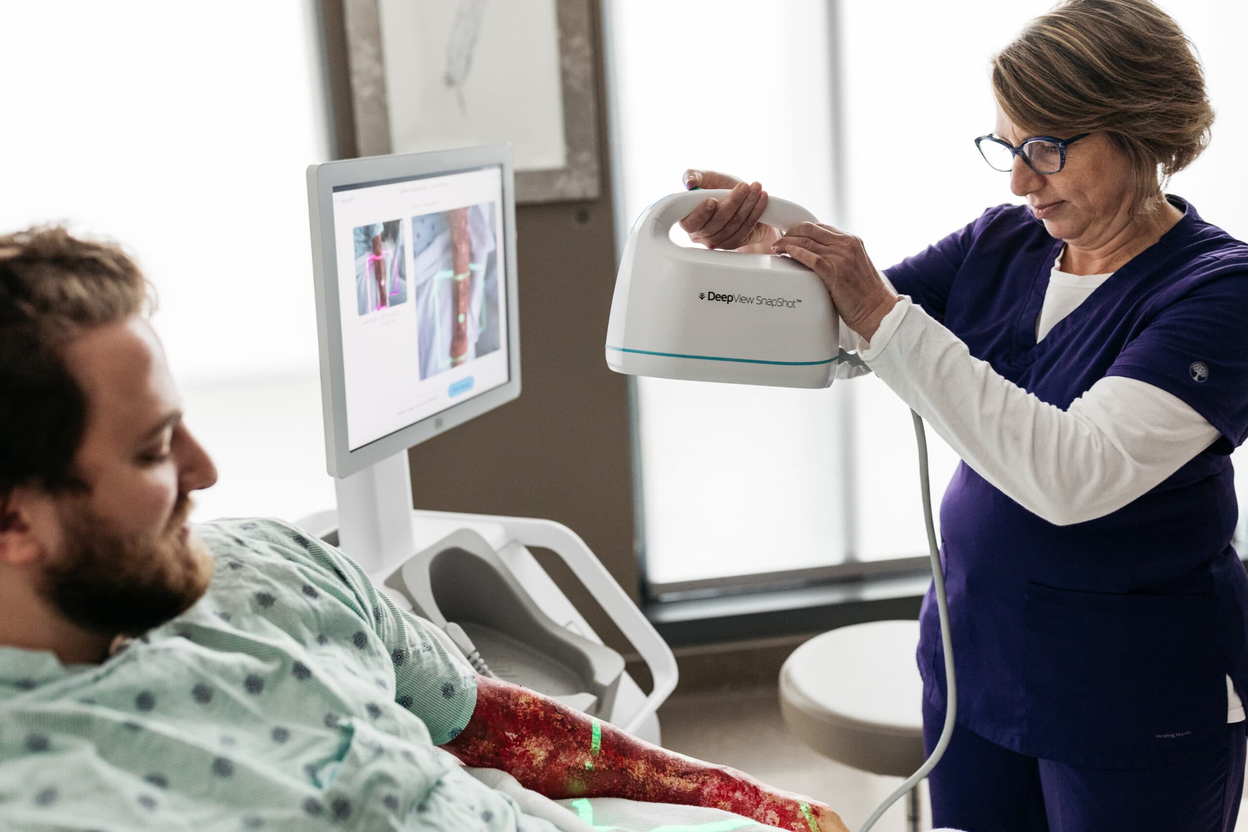 Spectral AI's DeepView Breakthrough Revolutionizes Burn Care with 95% Accuracy